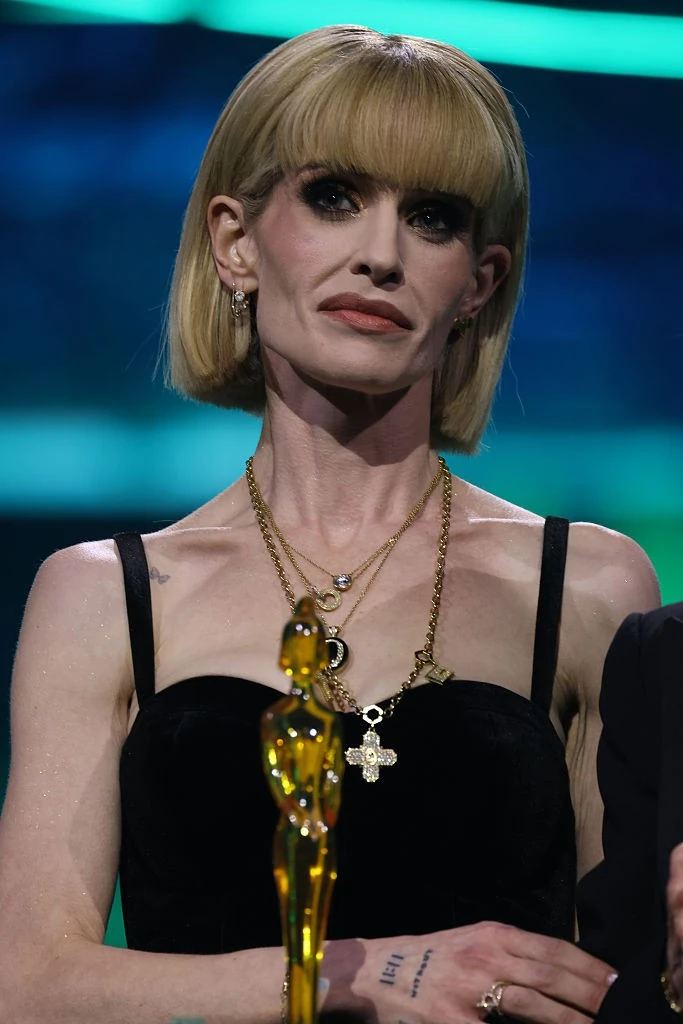 Kelly Osbourne szó szerint csont és bőr lett