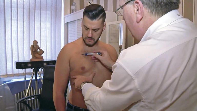 Mellkisebbítő műtéttel szabadult meg a szégyenérzettől Kökény Attila