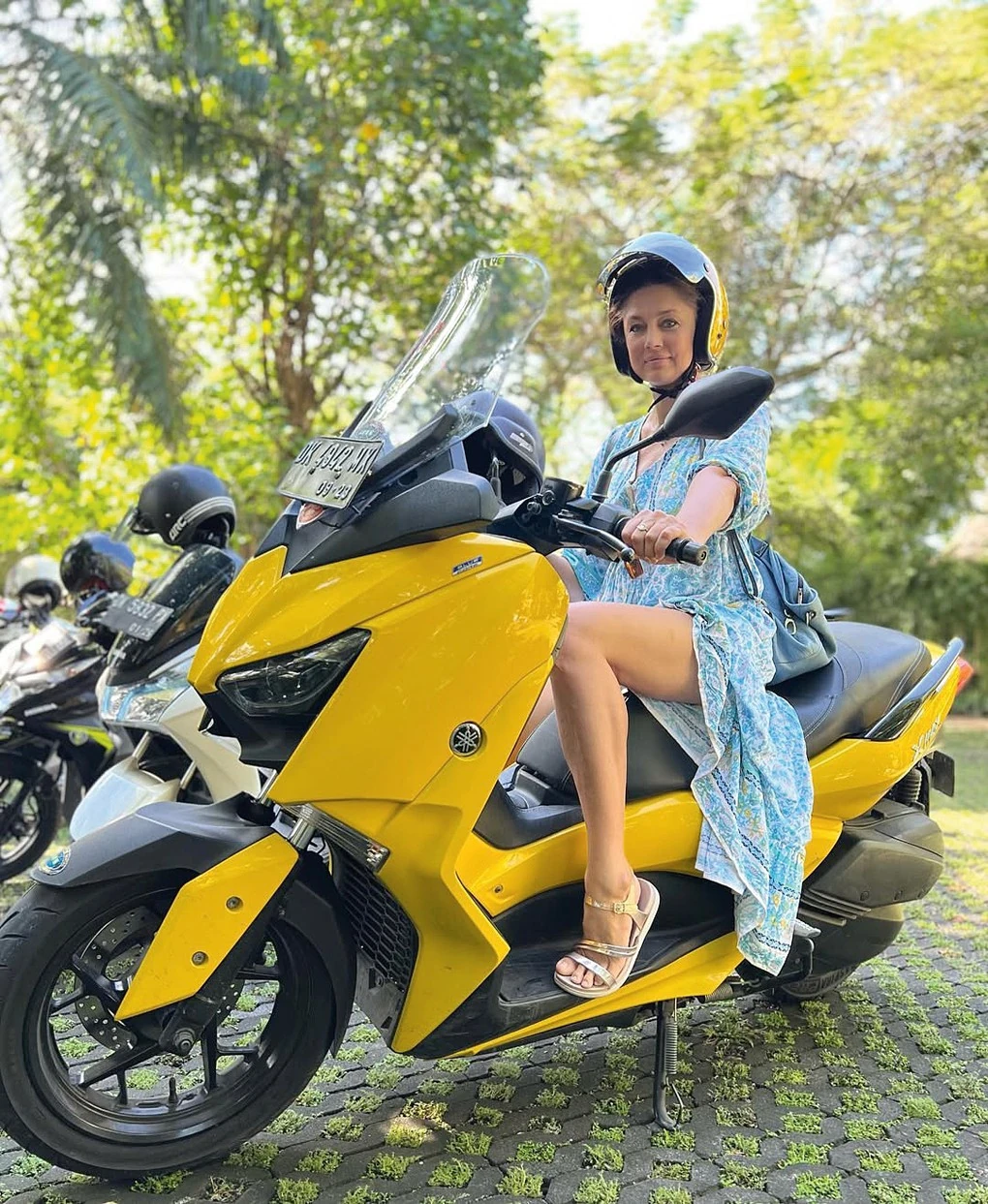 Motorbaleset okozta a sérüléseit