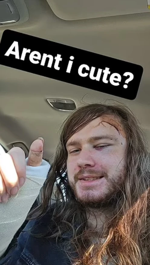 Látható, hogy nagy a baj...