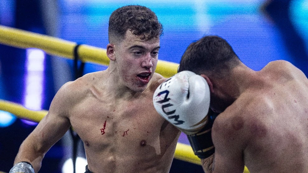 Norbinak hamar vérezni kezdett az orra, de ez sem kényszerítette meghátrálásra (Fotó: Trenka Attila)