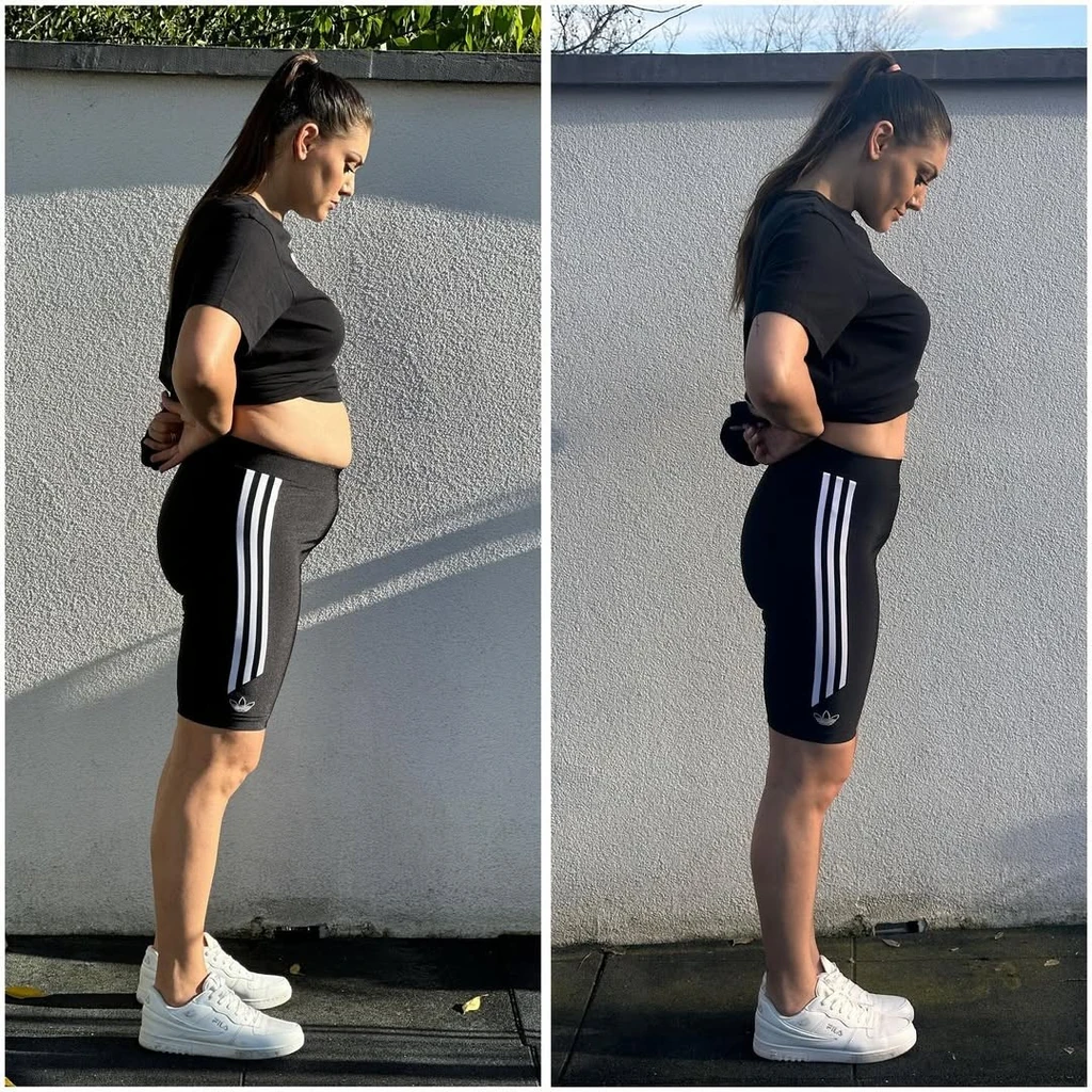 Edina szépen halad (Fotó: Instagram)