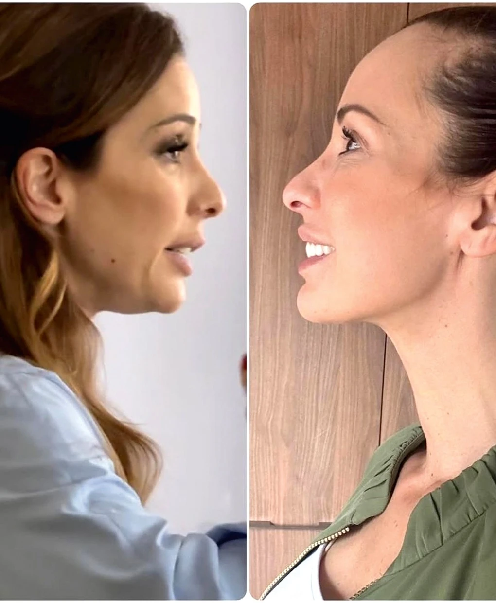 Demcsák Zsuzsa a műtét előtt és után (Fotó: Archív)