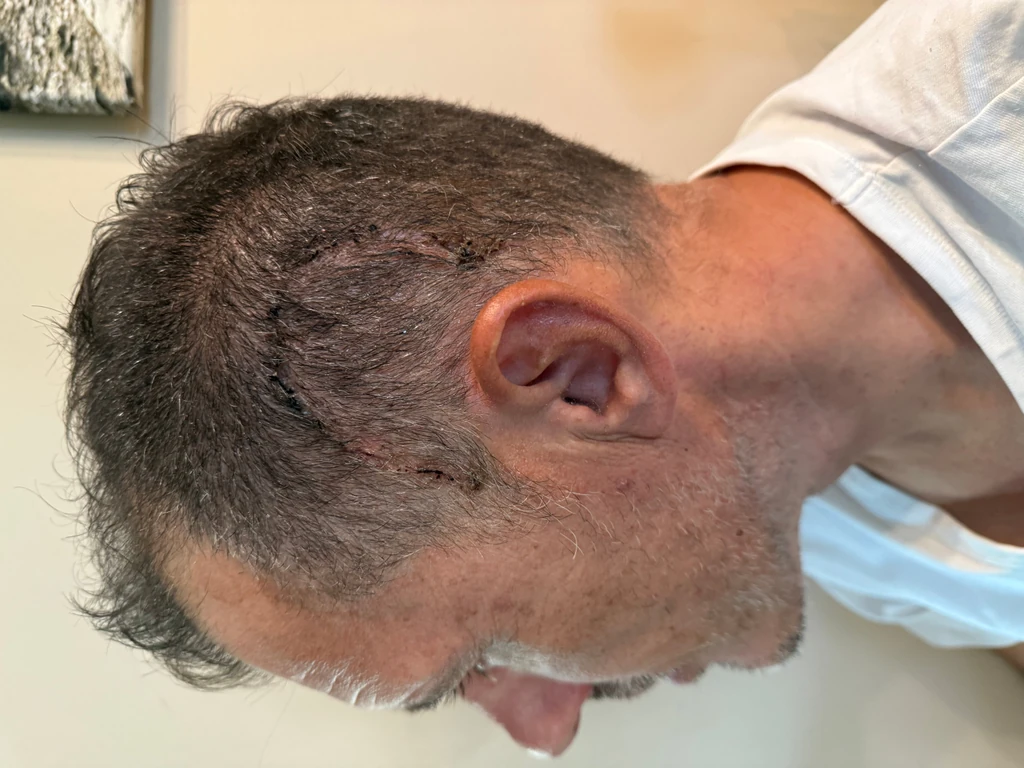 Az operáció sikerült, de ez még sajnos nem elég. (Fotó: Archív)